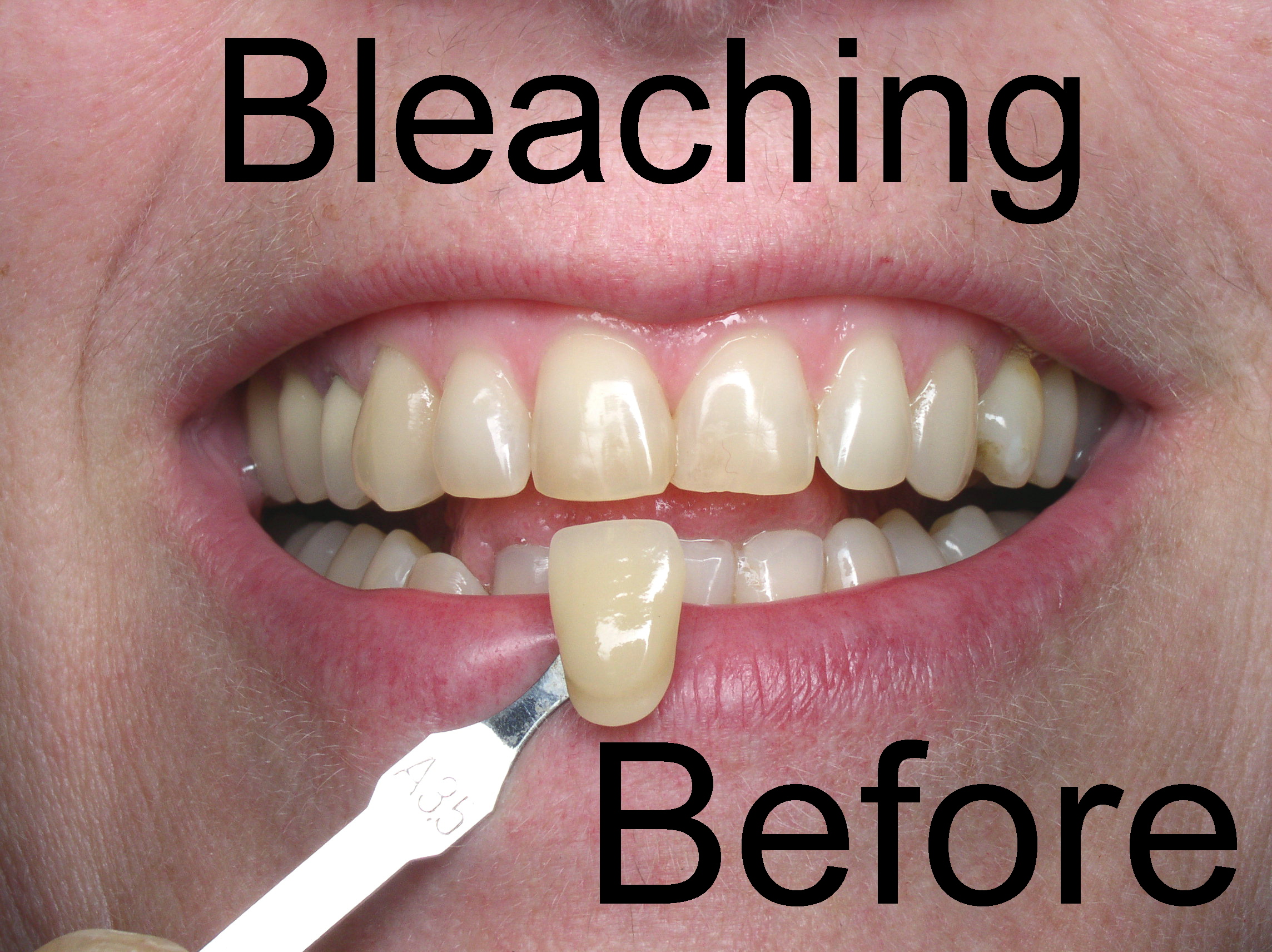 Bleaching Before